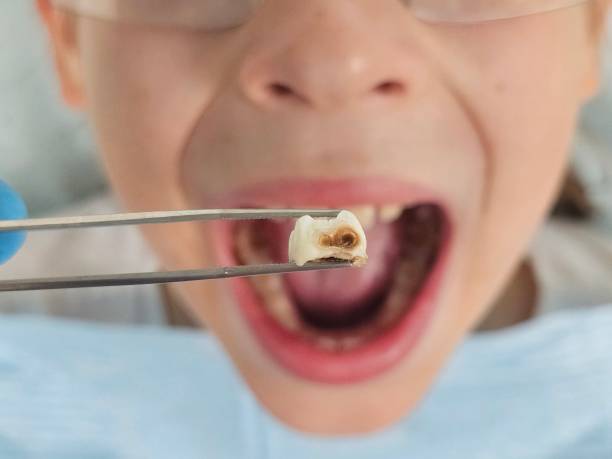 Best Chipped Tooth Repair Near Me  in Mcnair, VA